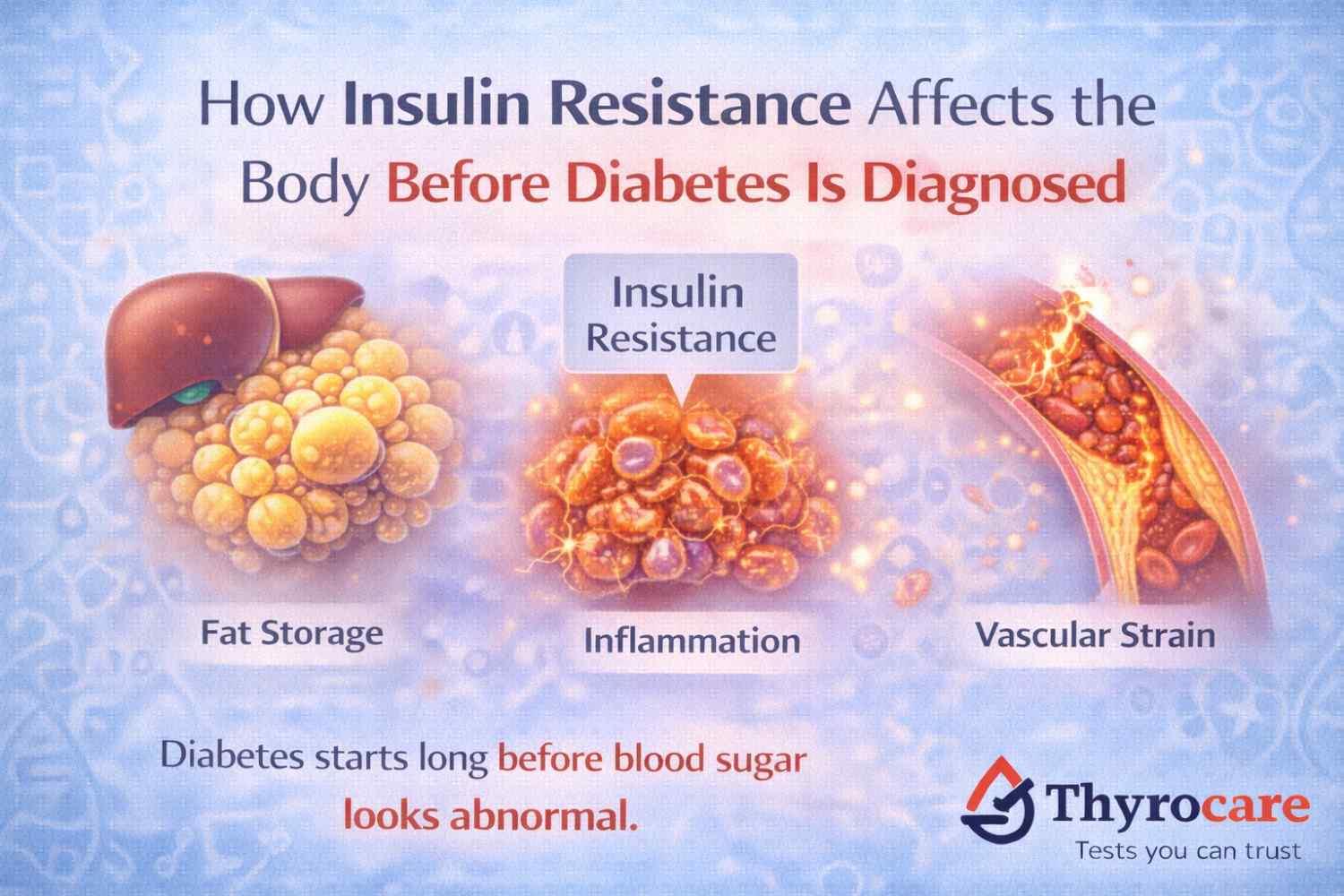How Insulin Resistance Affects the Body Before Diabetes Is Diagnosed