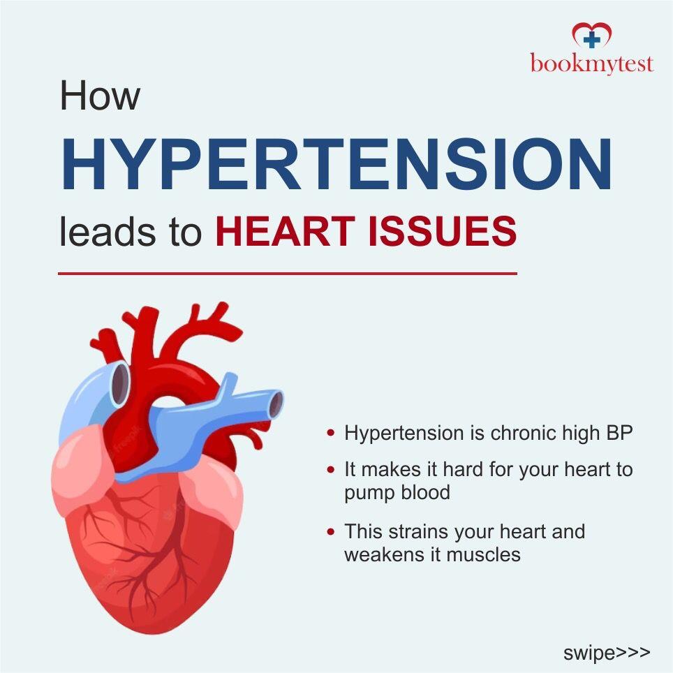How Hypertension Leads to Heart Issues