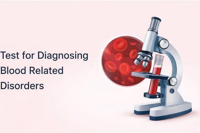 Peripheral Blood Smear Test: What It Is and Why It Is Done