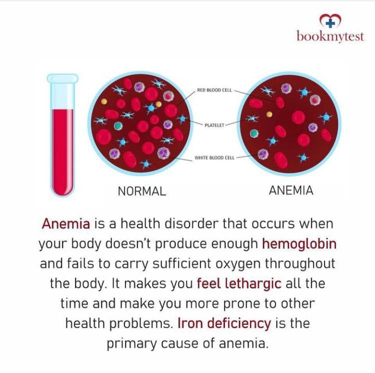 Iron Deficiency Anemia - Bookmytest