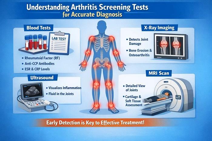Understanding Arthritis Screening Tests for Accurate Diagnosis