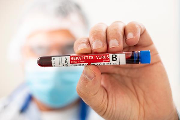 HEPATITIS B PROFILE