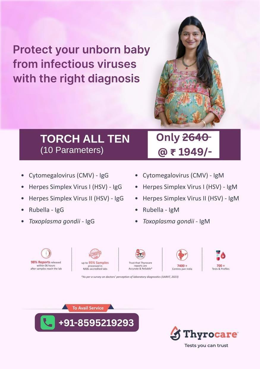 TORCH ALL TEN (C.M.I.A)